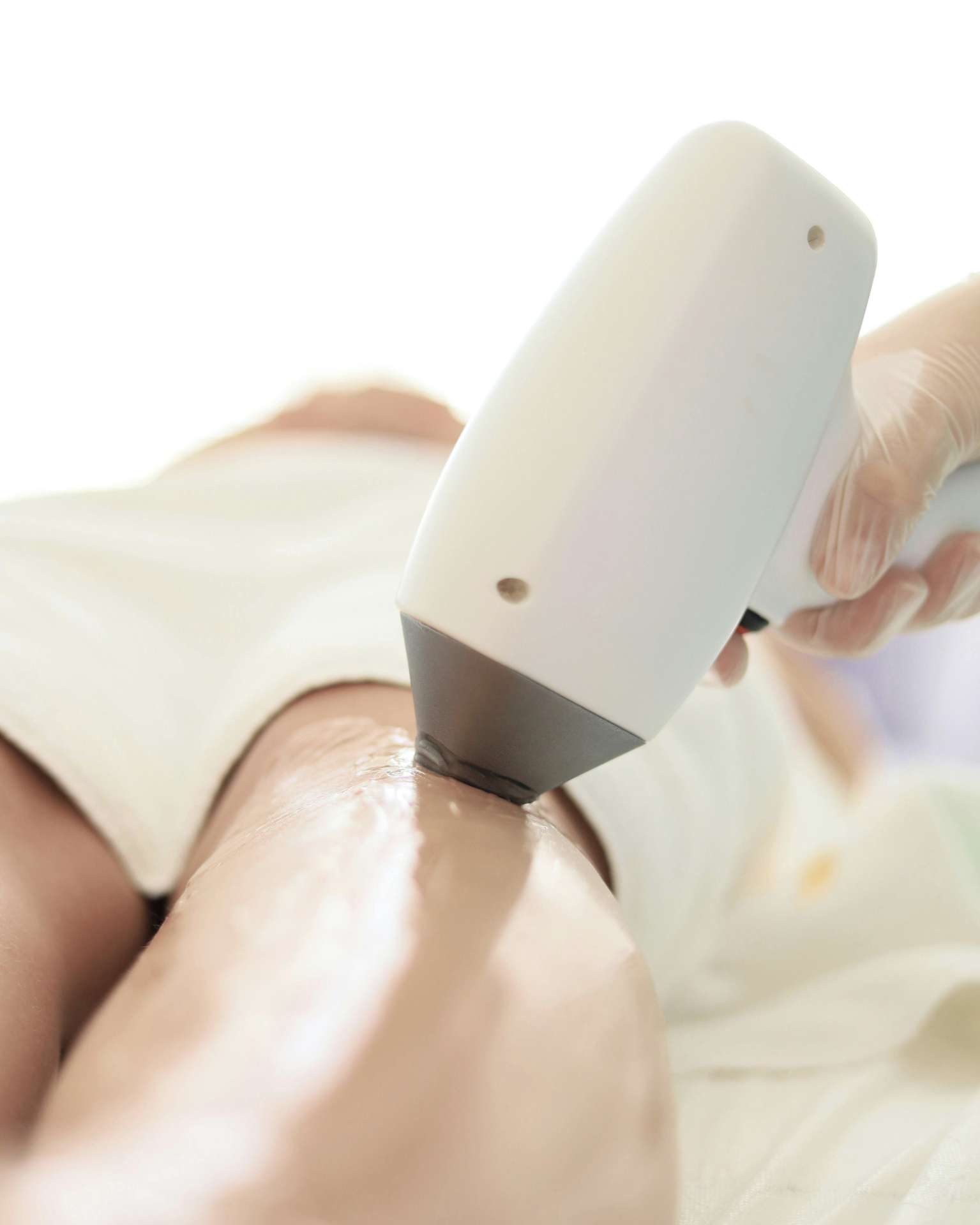 Laser Hair Removal